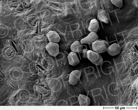 Gymnosporangium fuscum (Birnengitterrost)