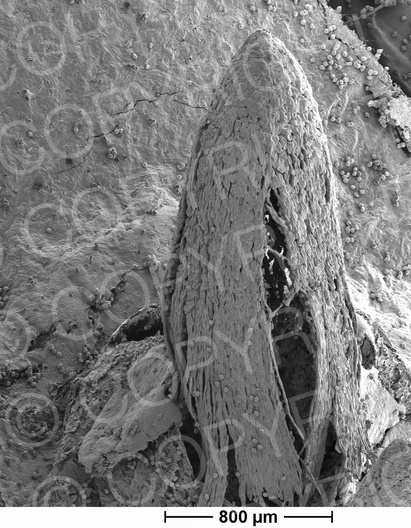 Gymnosporangium fuscum (Birnengitterrost)